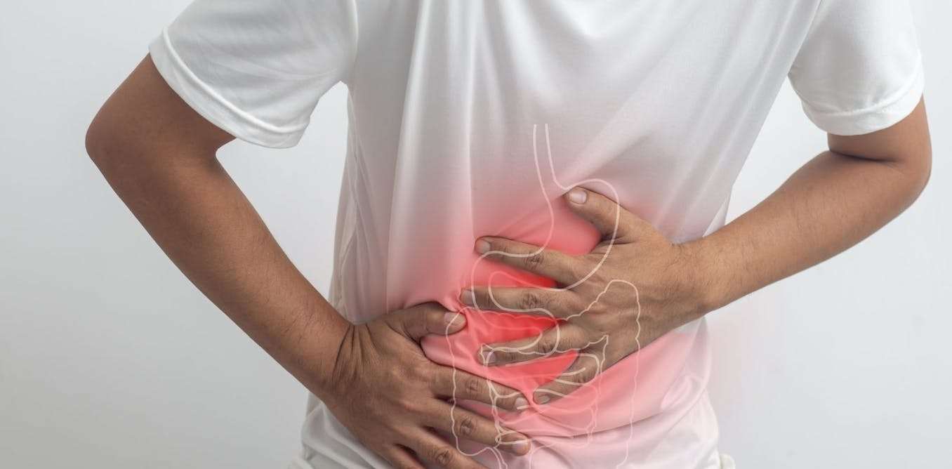 the surprisingly common gut condition you’ve probably never heard of