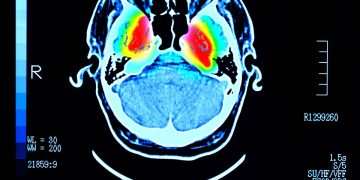 Common drink could raise dementia risk – even ‘modest amounts’