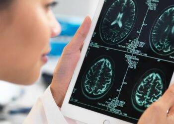 Alzheimer’s could be detected early by simple memory test