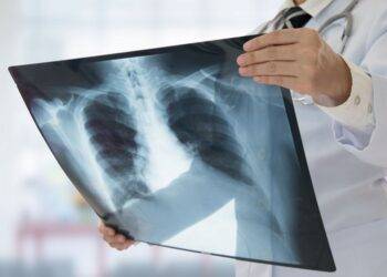 Doctor shares fives changes to your body that could be signs of lung cancer