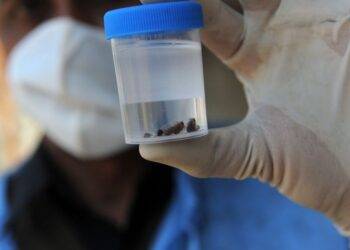 Woman in UK diagnosed with new Ebola-like disease with 40% mortality rate