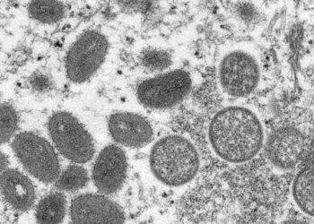 Monkeypox outbreak could be monitored by Covid-like tracker as UK cases hit 90