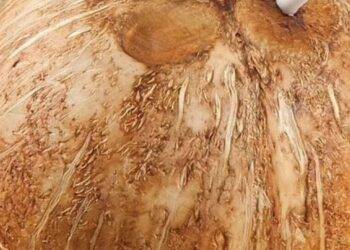 Tragedy as man dies after a sip from popular holiday drink left him with severe brain damage within hours