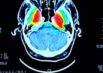 Common drink could raise dementia risk – even ‘modest amounts’